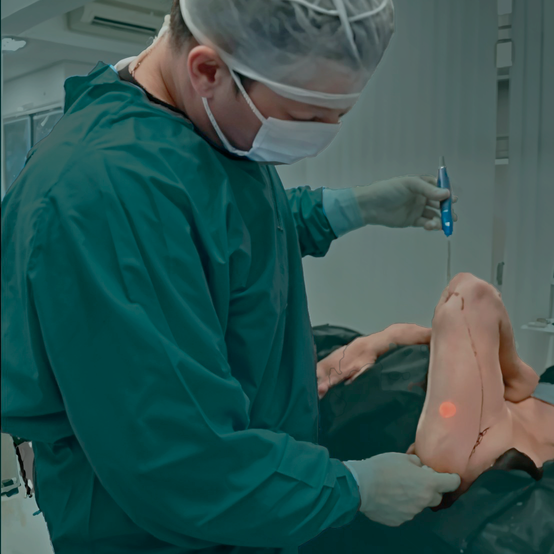 Procedimento Minilipolaser